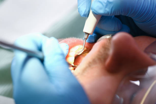 Best Emergency Treatment for Oral Infections in Lewisburg, WV